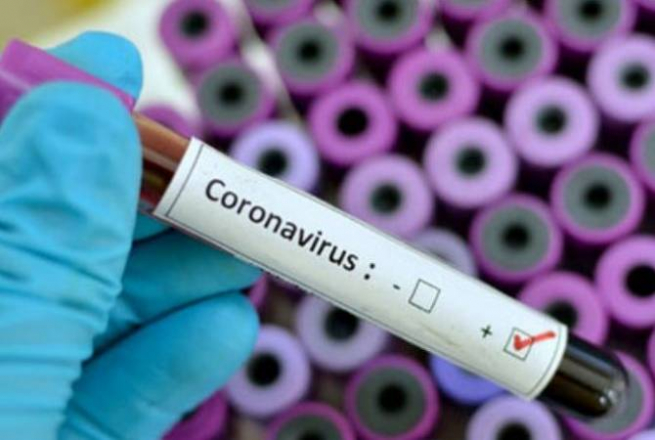 В Шепетівці лабораторно підтверджено 7 випадків захворювання COVID-19