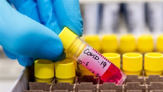 Ще у трьох шепетівчан підтверджено захворювання на коронавірусну інфекцію COVID-19