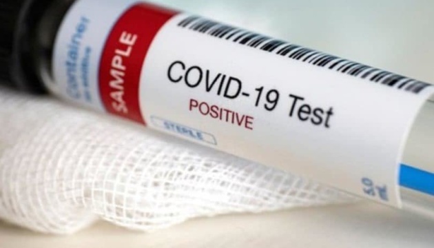 У Шепетівці підтверджено ще один випадок захворювання на COVID-19