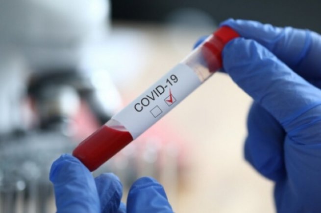 25 шепетівчан продовжують лікування від COVID-19 - інформація станом на 18 серпня 12.00
