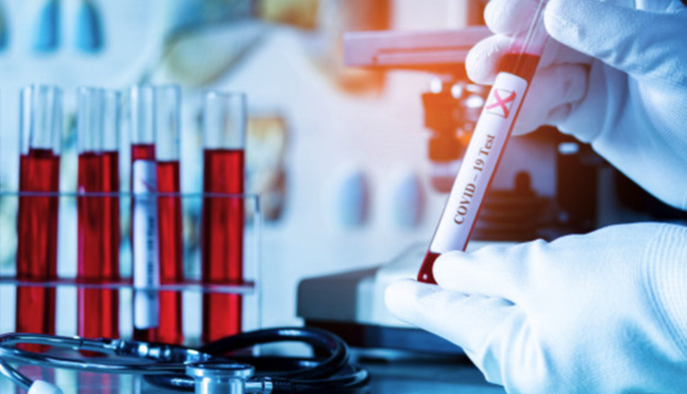 У Шепетівці зареєстровано 60 лабораторно підтверджених випадків захворювання на COVID-19