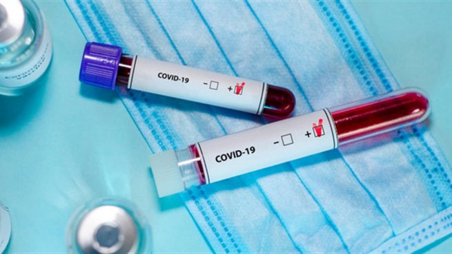 У Шепетівці підтверджено 3 нових випадки захворювання на COVID-19